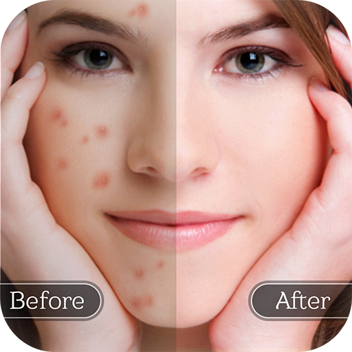 Face Blemish Remover - Smooth icon